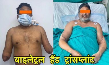 Bilateral Hand Transplant: दिल्ली के चिकित्सकों ने पेंटर को दिये नये हाथ