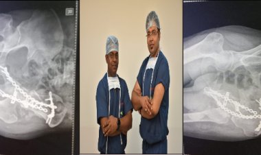 कूल्हे एवं पेल्विस बोंस की दोनों टूटी हड्डियों को पारस के चिकित्सकों ने सर्जरी कर ठीक किया