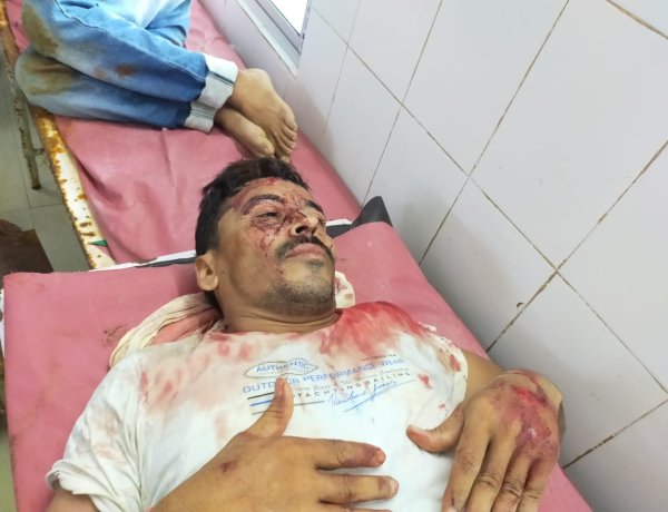 बाबा नगरी में जमीन कब्जा को लेकर भू मफ़ियाओं ने मारपीट कर चार को किया घायल।