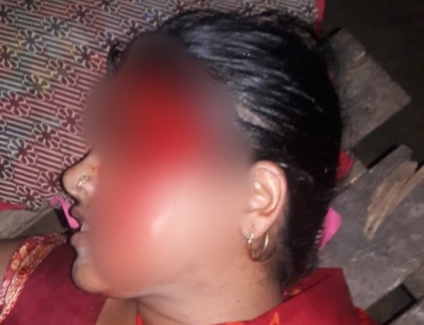 चचेरे देवर तथा ससुर ने युवती पर किया रड एवं फरसा से प्रहार,एफआईआर दर्ज