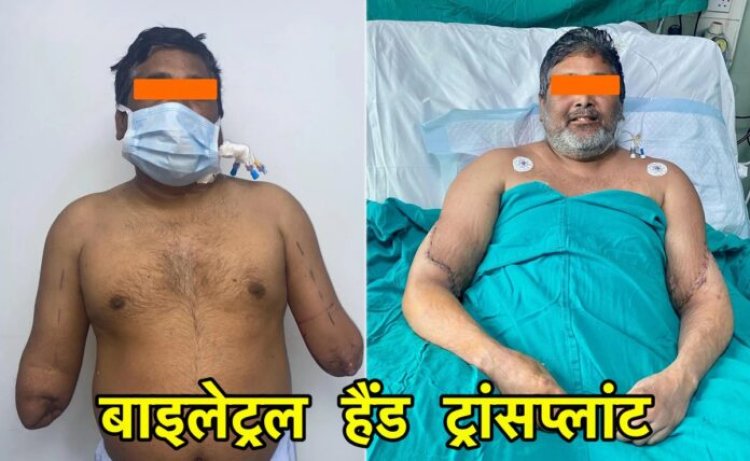 Bilateral Hand Transplant: दिल्ली के चिकित्सकों ने पेंटर को दिये नये हाथ