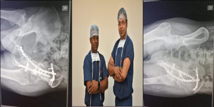 कूल्हे एवं पेल्विस बोंस की दोनों टूटी हड्डियों को पारस के चिकित्सकों ने सर्जरी कर ठीक किया