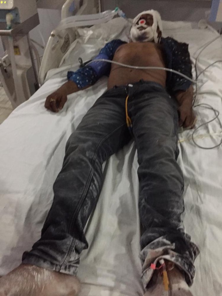 पत्रकार पर हमला करनेवाले अपराधी 72 घंटा में गिरफ्तार नहीं हुए तो रांची बंद बुलाया जाएगा – विजय नायक